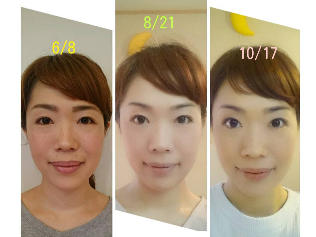 嵐 通路 ブラウン 若返る Martialren Org